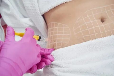 Body Contouring (HIFU/RF/Ultrasound)